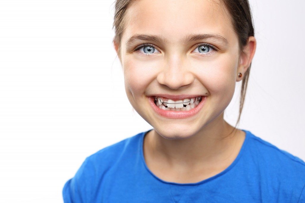 girl with crooked teeth