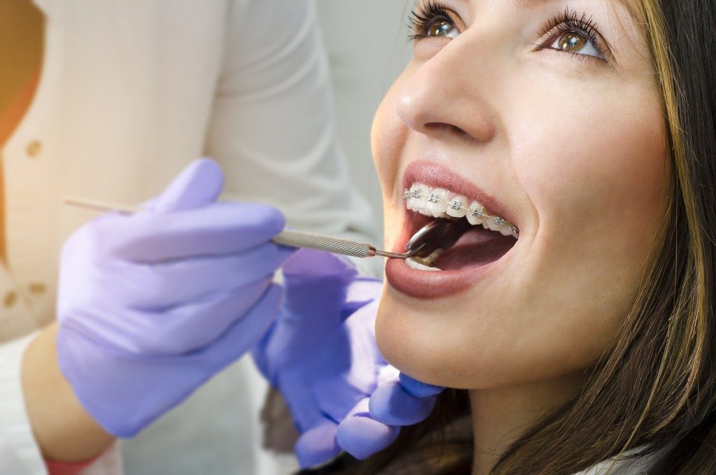 closeup of a woman having her braces check in a dental clinic