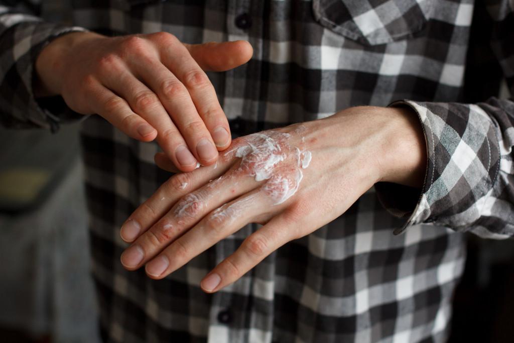 man applying hand cream